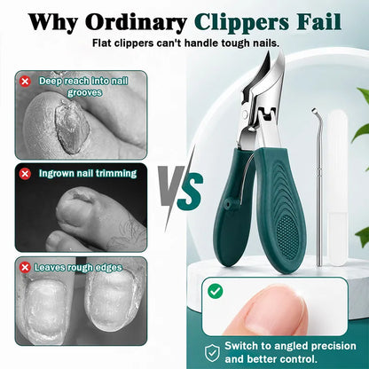 Eagle Beak Angled Nail Clippers 3-Piece Set (With Nail Lifter & File) — Podiatrist-Grade Thick & Ingrown Toenail Trimmer 🦶✂️